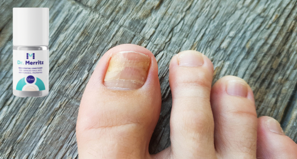 Dr Merritz - ¿precio y dónde comprar? Amazon, Farmacia