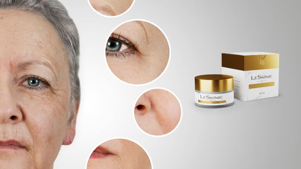 LeSkinic - ¿qué es y cómo funciona?