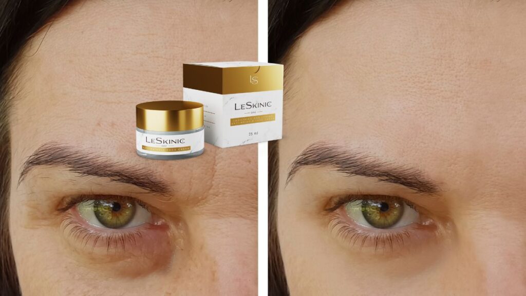 LeSkinic - ¿Tiene efectos secundarios o contraindicaciones?
